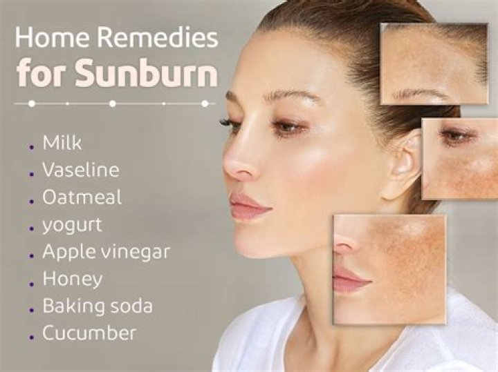 How do you get rid of sun burn marks?