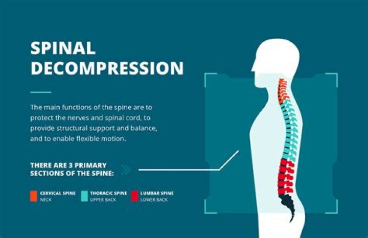 What does it mean to decompress your spine?