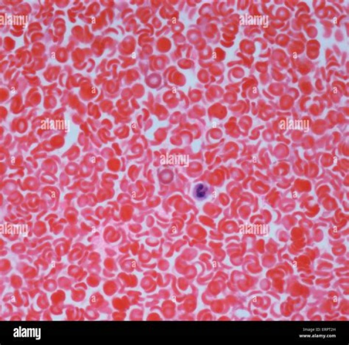 What type of microscope do you need to see blood cells?